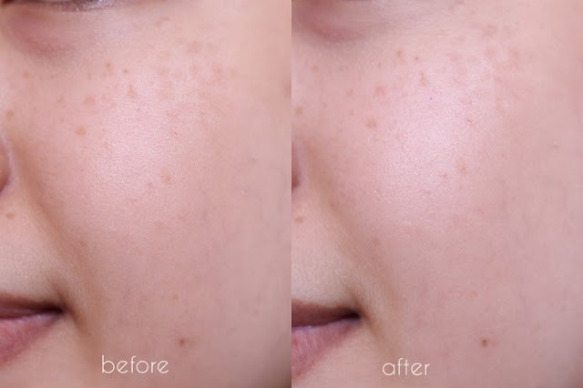 Before After BIO-ESSENCE GOLD WATER REVIEW RAHMALIA-6